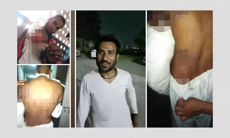 POCSO Court Acquits Muslim Man Whose Arm Was Amputated In Alleged Hate Crime