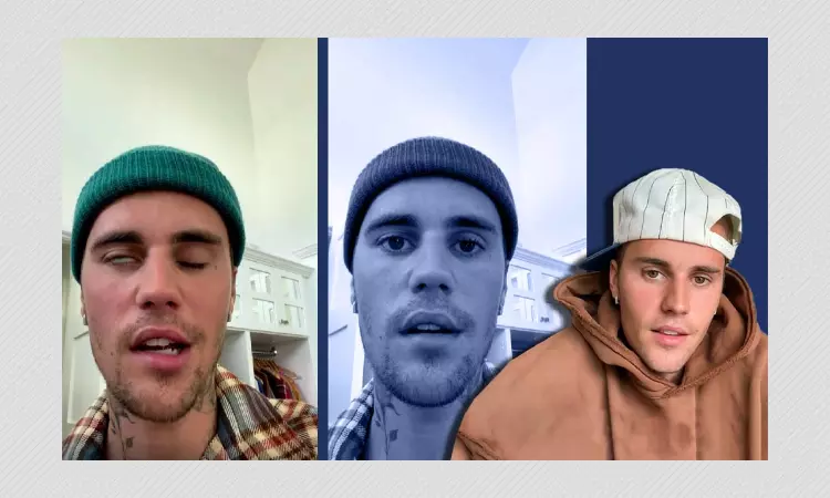 What is Ramsay Hunt Syndrome, The Condition Affecting Justin Bieber?