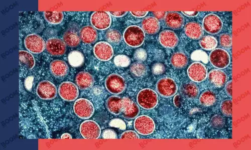 India Reports First Monkey Pox Case In Kerala: What Is It Really?