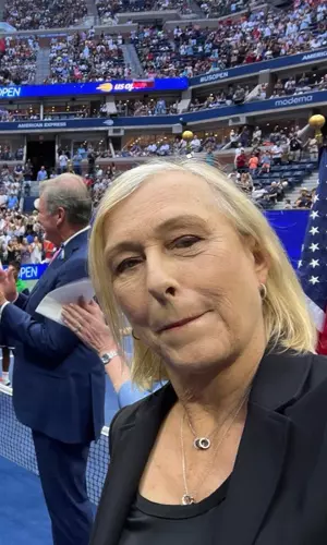 Former Tennis Player Martina Navratilova Diagnosed With Throat, Breast Cancer