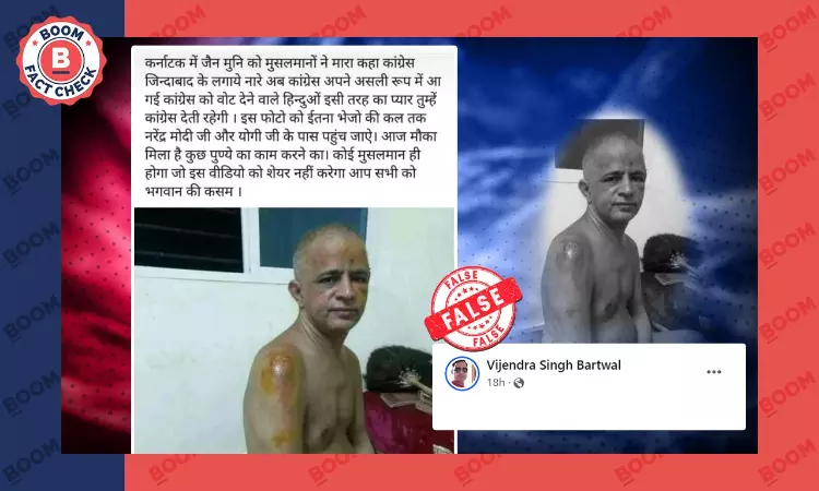 Photo of Injured Jain Monk Revived With False Communal Claim