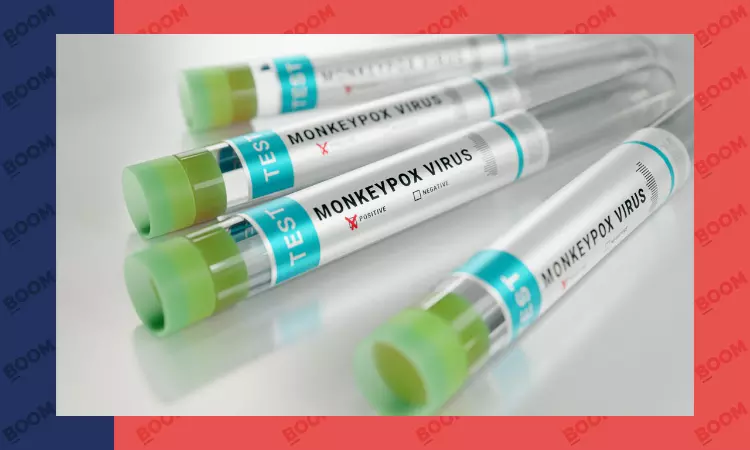 Is India Prepared For Mpox Outbreak? Experts Explain Symptoms And Precautions