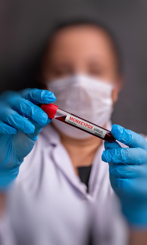 India Confirms An Isolated Mpox Case, Not Linked To WHO Global Health Emergency: Centre