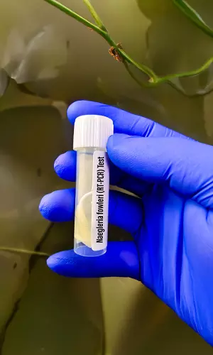 Kerala Battles Deadly Brain-Eating Amoeba As Cases Rise